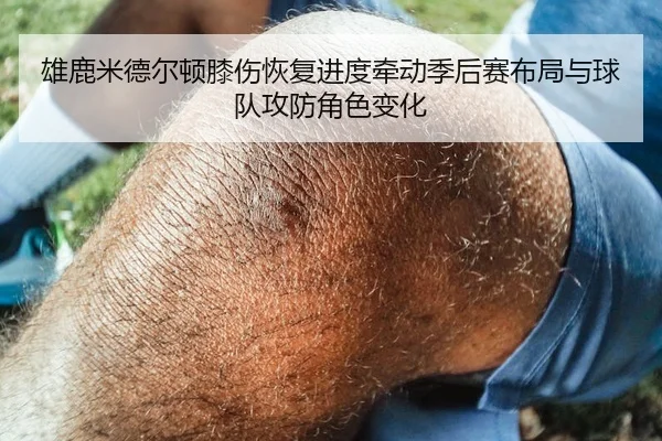 雄鹿米德尔顿膝伤恢复进度牵动季后赛布局与球队攻防角色变化